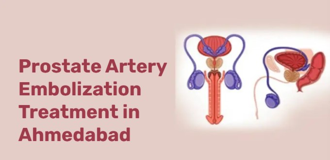 Questions to Ask the Best Prostate Treatment Specialist in Ahmedabad best thyroid treatment in Ahmedabad